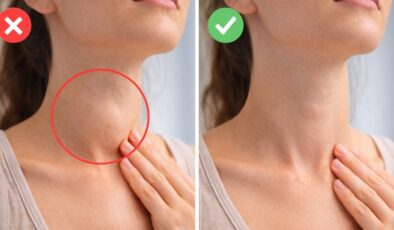 Evde tiroid kontrolü: Aynaya geçin, hemen deneyin…