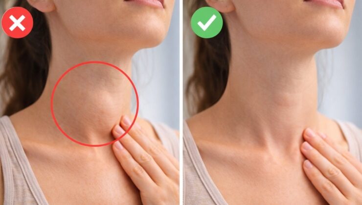 Evde tiroid kontrolü: Aynaya geçin, hemen deneyin…