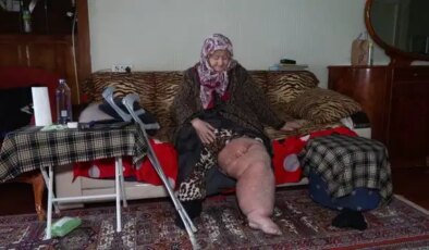Fil hastalığıyla mücadele ederken oturduğu evin yıkılacağını öğrendi: ‘Bacağım bu haldeyken nereye gideceğim’