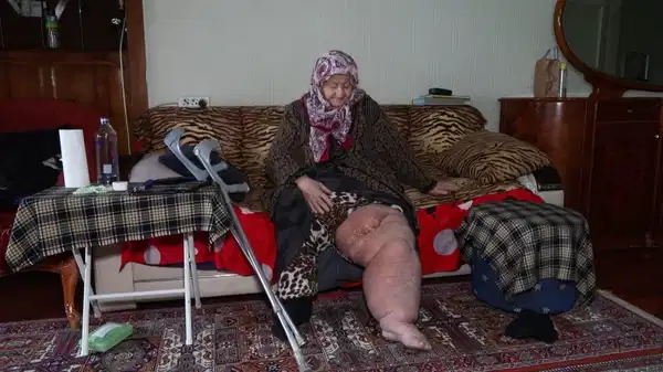 Fil hastalığıyla mücadele ederken oturduğu evin yıkılacağını öğrendi: ‘Bacağım bu haldeyken nereye gideceğim’
