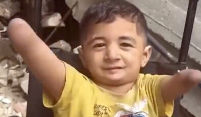 İsrail zulmünün utanç karesi: Gazzeli küçük Amir, uzuvlarını kaybetti