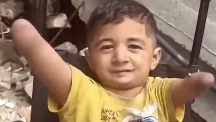 İsrail zulmünün utanç karesi: Gazzeli küçük Amir, uzuvlarını kaybetti