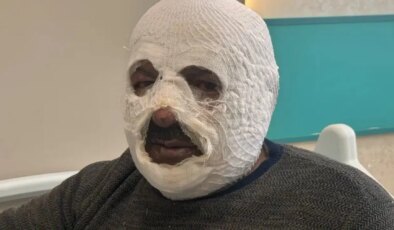 Kaloriferi yakmak isterken yandı: Madende feci kaza