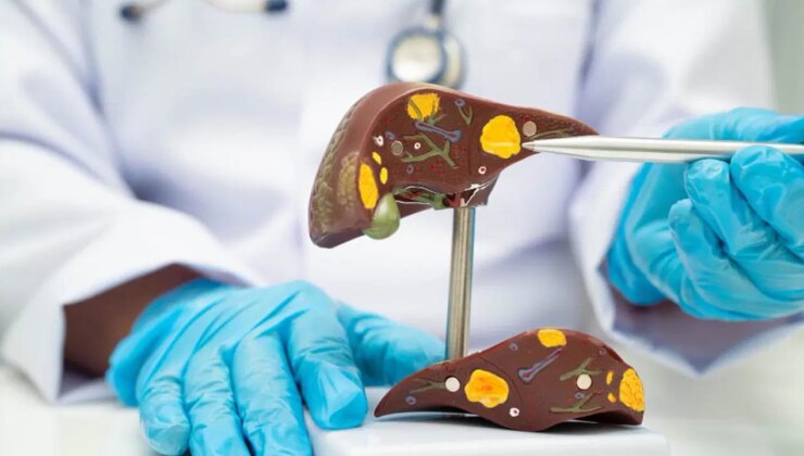 Karaciğer kanserine giden yol: Hepatit B’ye dikkat