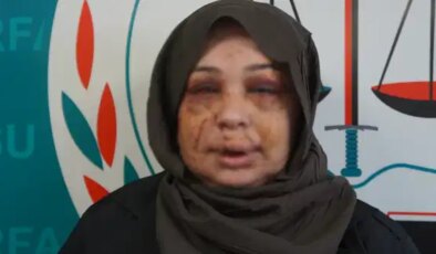 Polis eşi tarafından darbedildiği iddiasıyla şikayetçi oldu: ‘Vicdanı olan herkesten yardım istiyorum’