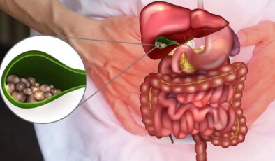 Safra kesesi ameliyatlarının artmasının nedeni zayıflama iğneleri olabilir