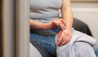 Sıcak su cildin koruyucu bariyerini eritiyor: Kış egzamasının en büyük tetikleyicisi…