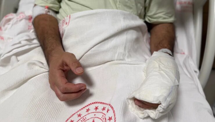 Sıcak torbası patlamasıyla vücudunun yüzde 30’u yandı: ‘5 dakika geçti, patladı’