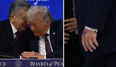 Trump’ın elindeki morluğun nedeni belli oldu