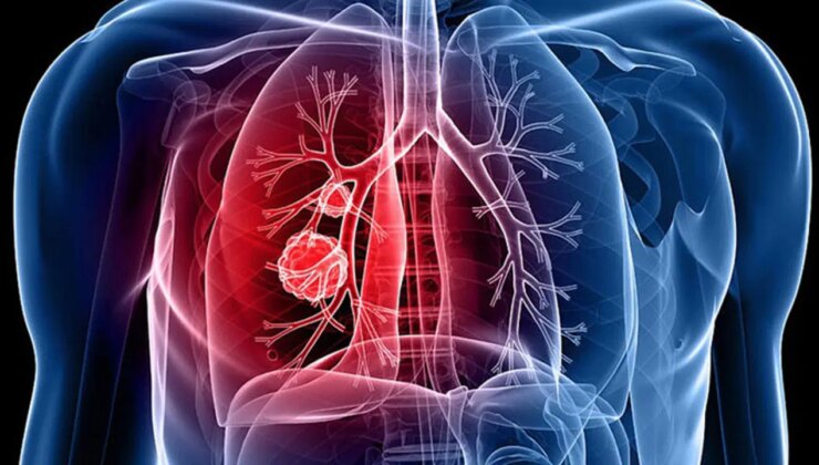 Veremde erken tanı, doğru ve düzenli tedavi hayati önem taşıyor