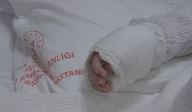 20 aylık bebeğin üzerine kaynar su döküldü: Vücudunun yüzde 27’si yandı!