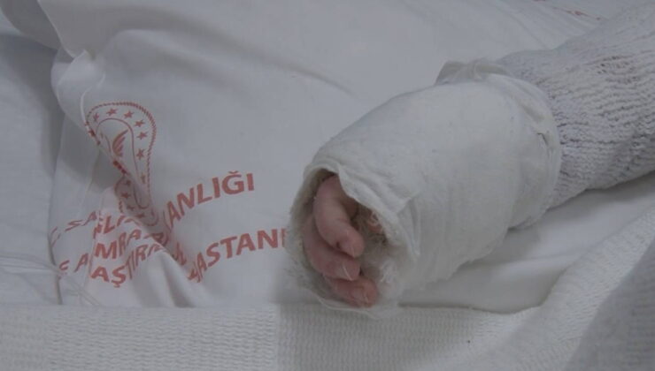 20 aylık bebeğin üzerine kaynar su döküldü: Vücudunun yüzde 27’si yandı!