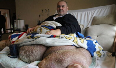 300 kiloya ulaşan fil hastası 30 kişi tarafından evinden çıkarıldı!