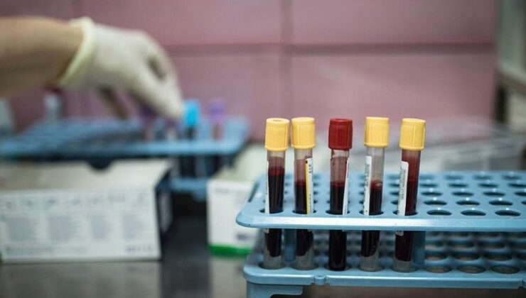 Dünyada her yıl 20 milyon, Türkiye’de ise 240 bin kişi kanser tanısı alıyor