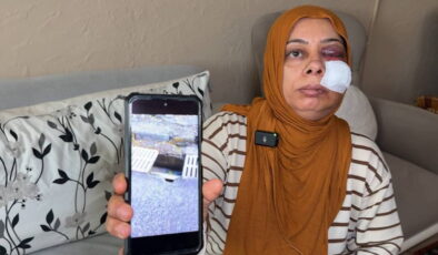 Elektrikli bisikleti ile kapağı kırık rögara düştü: Yüzüne 14 dikiş atıldı