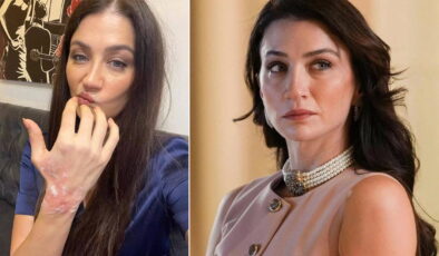 Eşref Rüya dizisinin setinde korkutan kaza: Ceren Benderlioğlu hastanelik oldu!