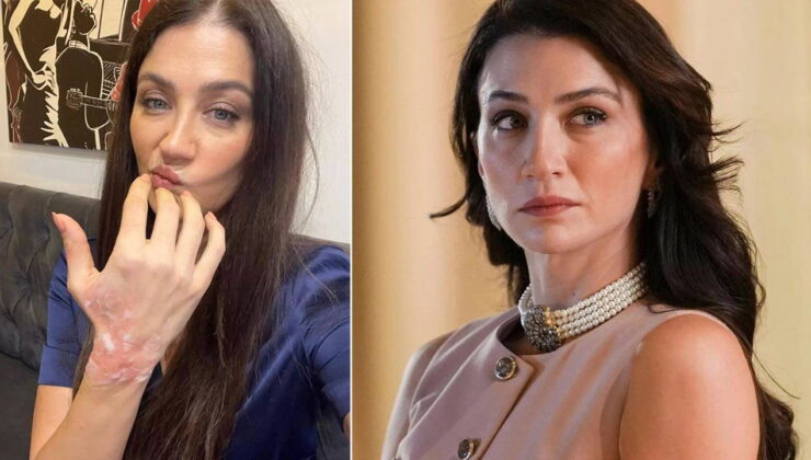 Eşref Rüya dizisinin setinde korkutan kaza: Ceren Benderlioğlu hastanelik oldu!