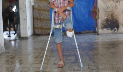 Gazze’de ampute ikizler tedaviye ulaşamıyor