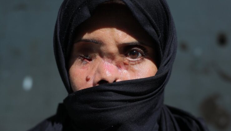 Gazze’de öldü sanılıp kefenlendikten sonra hayatta olduğu tespit edildi