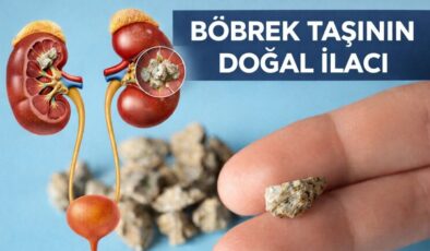 Her gün 1 avuç yiyin: Böbrek taşını kaydırıp atıyor…