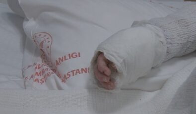 İstanbul’da bebeğin üzerine kaynar su döküldü: Vücudunun yüzde 27’si yandı