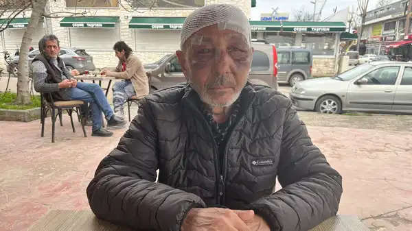 Önce çakmak istediler ardından sokak ortasında darbettiler