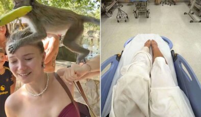 Sosyal medya fenomeni, maymun saldırısına uğradı