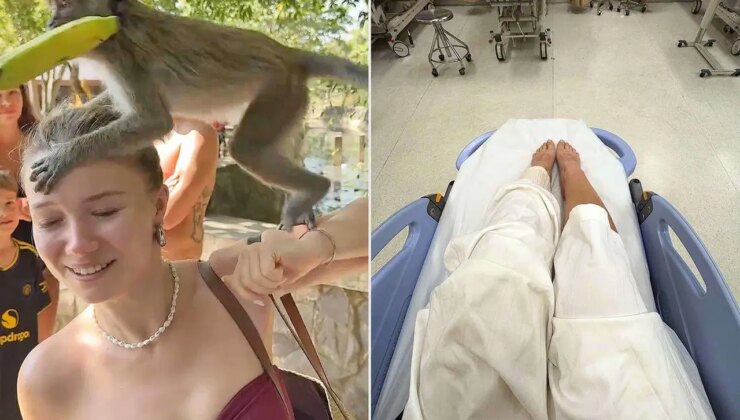 Sosyal medya fenomeni, maymun saldırısına uğradı