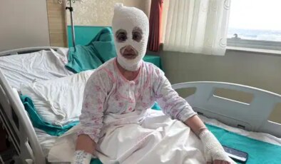 İftar saati ‘düdüklü tencere’ faciası: Bomba gibi patladı! ‘Aynaya baktıktan sonra bayılmışım…’