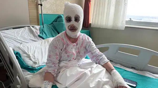 İftar saati ‘düdüklü tencere’ faciası: Bomba gibi patladı! ‘Aynaya baktıktan sonra bayılmışım…’