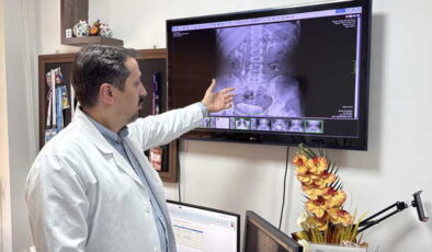 Doktorlar bile şaşırdı: İdrar kanalından 51 taş çıkarıldı!