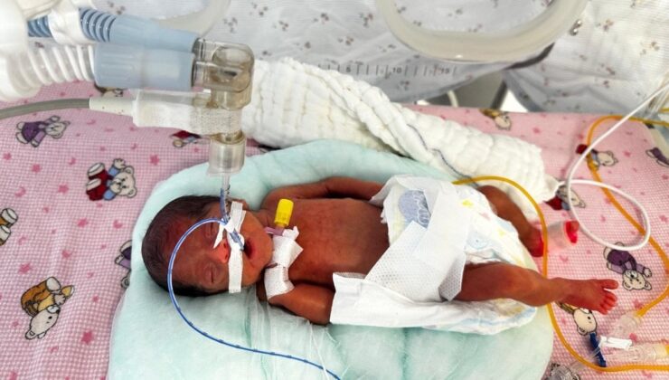 Antalya’da 650 gram doğan bebek hayata tutundu