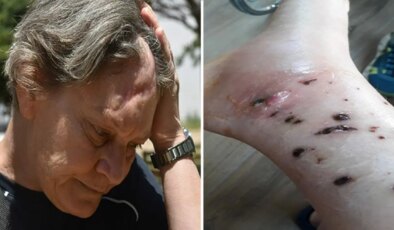 ‘Eğitimim yok’ demesine rağmen köpek bakımında çalıştırıldı, saldırıya uğradı: ‘Şirket sahibinin hesap vermesini istiyorum’