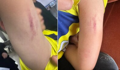 10 yaşındaki çocuk tartıştığı çocuğun annesi tarafından darbedildi: Aile şikayetçi oldu