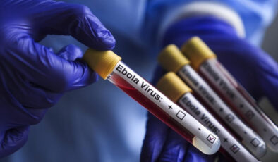 DSÖ: KDC’de Ebola salgınına ilişkin 5 bin 794 vaka ile 2 bin 786 ölüm bildirildi