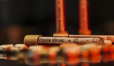 DSÖ Uganda’daki Ebola salgınının sona erdiğini doğruladı