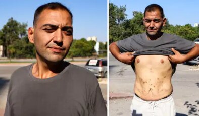 Tüp mide ameliyatı sonrası hayatı kabusa döndü, özel hastaneden şikayetçi oldu: ‘Günden güne eriyorum, yardım edin’