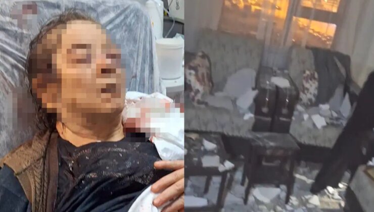 Evinde oturan kadının üzerine tavan çöktü: Görme kaybı yaşadı